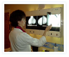 mammograph